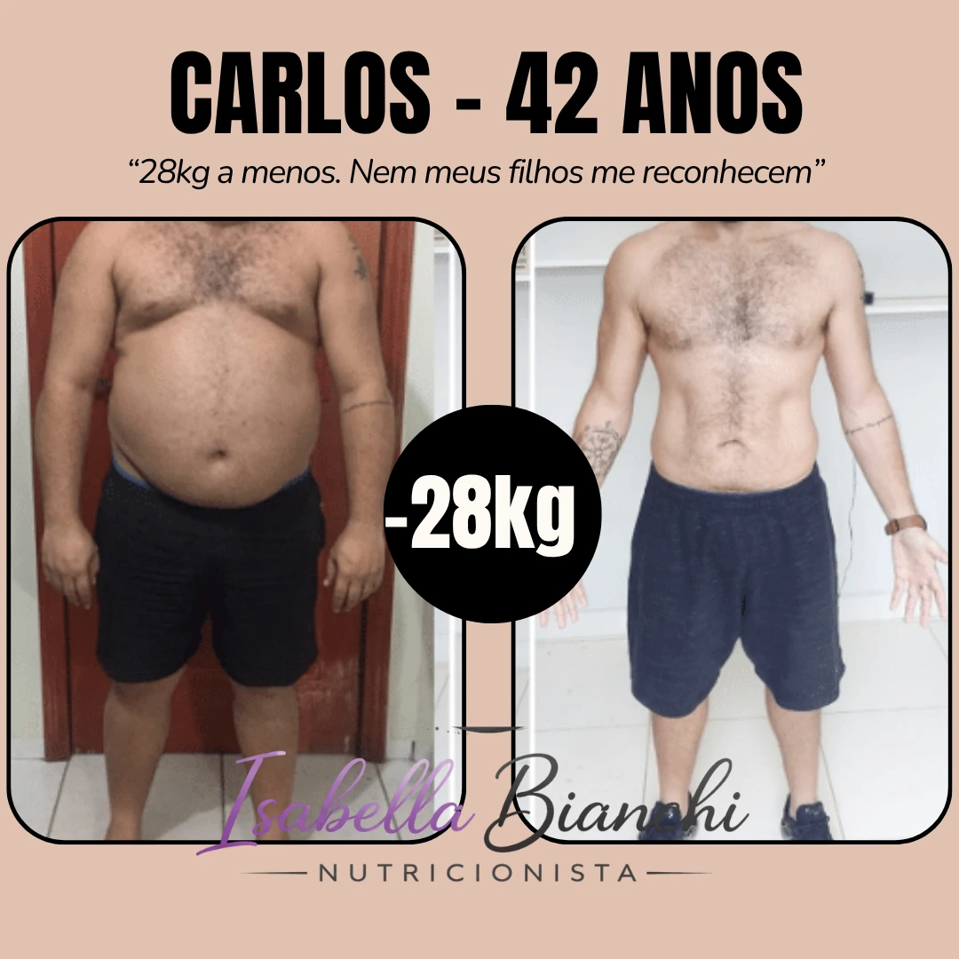 Carlos - Antes e Depois