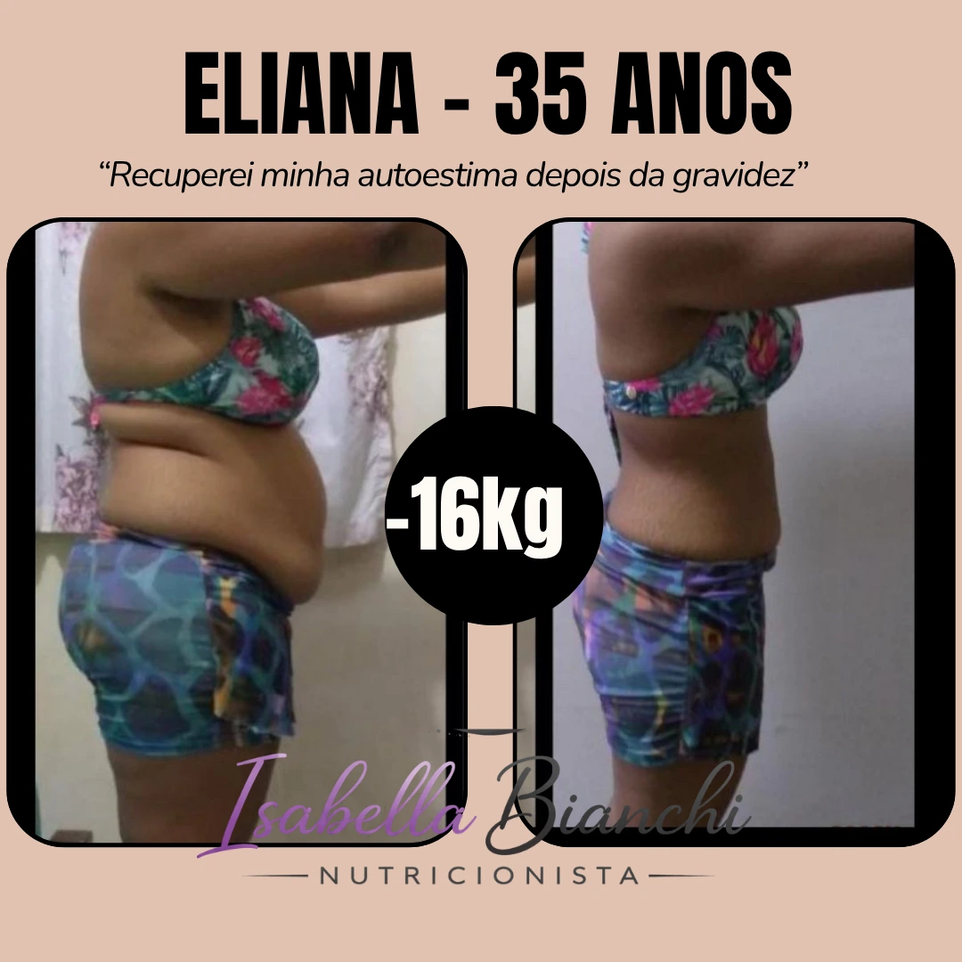 Eliana - Antes e Depois